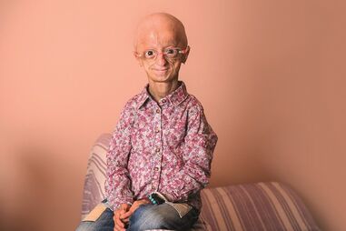 Cláudia Amaral sofria  de progeria, doença  genética rara