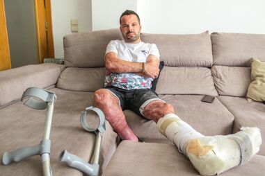 João Carraça com incapacidade de 77%