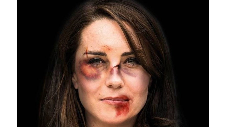 Kate Middleton campanha publicitária contra a violência