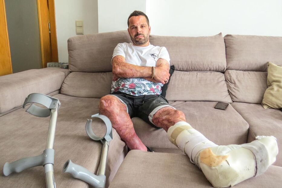 João Carraça com incapacidade de 77%