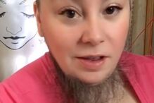 Mulher ‘barbuda’ aceita pelos no rosto e faz furor nas redes sociais