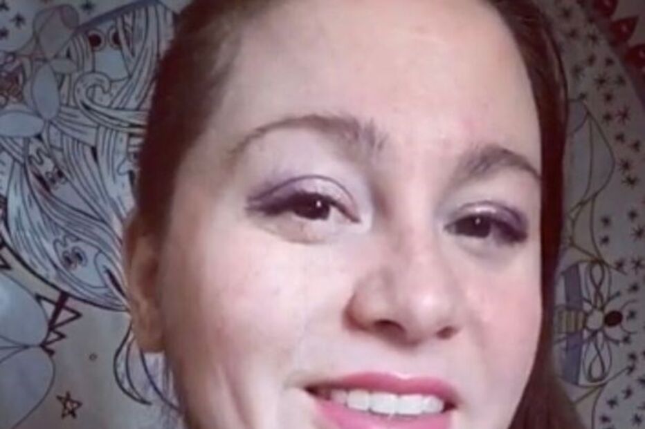 Mulher ‘barbuda’ aceita pelos no rosto e faz furor nas redes sociais