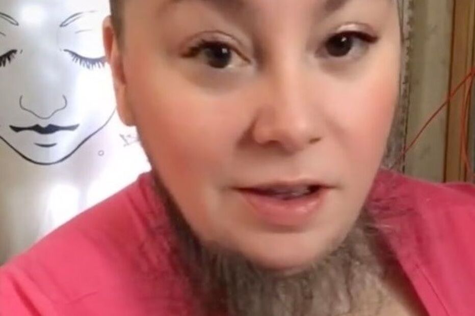 Mulher ‘barbuda’ aceita pelos no rosto e faz furor nas redes sociais