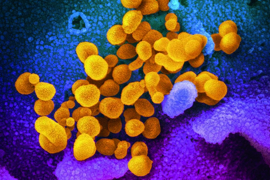 Imagem OMICRON.jpg (12303830) (Milenium)