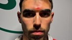 Ricardo Horta, do Sp. Braga, atingido na testa por garrafa de água atirada das bancadas em Alvalade