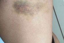 2022-01-30_10_25_20 foto2.jpg