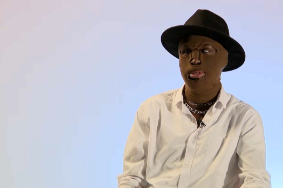 'Senti que estava a arder': Carlos explica aflição após ser atacado