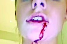 Harriet Robson mostrou as alegadas agressões