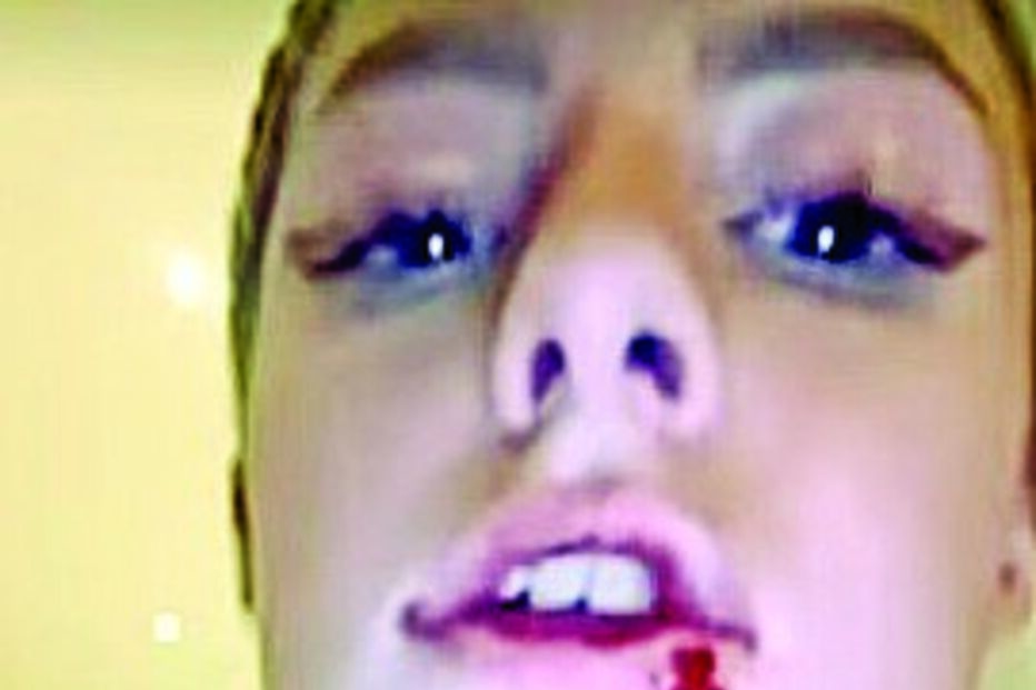 Harriet Robson mostrou as alegadas agressões