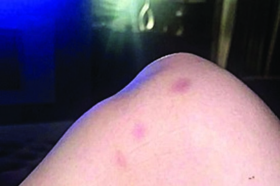 Harriet Robson mostrou as alegadas agressões