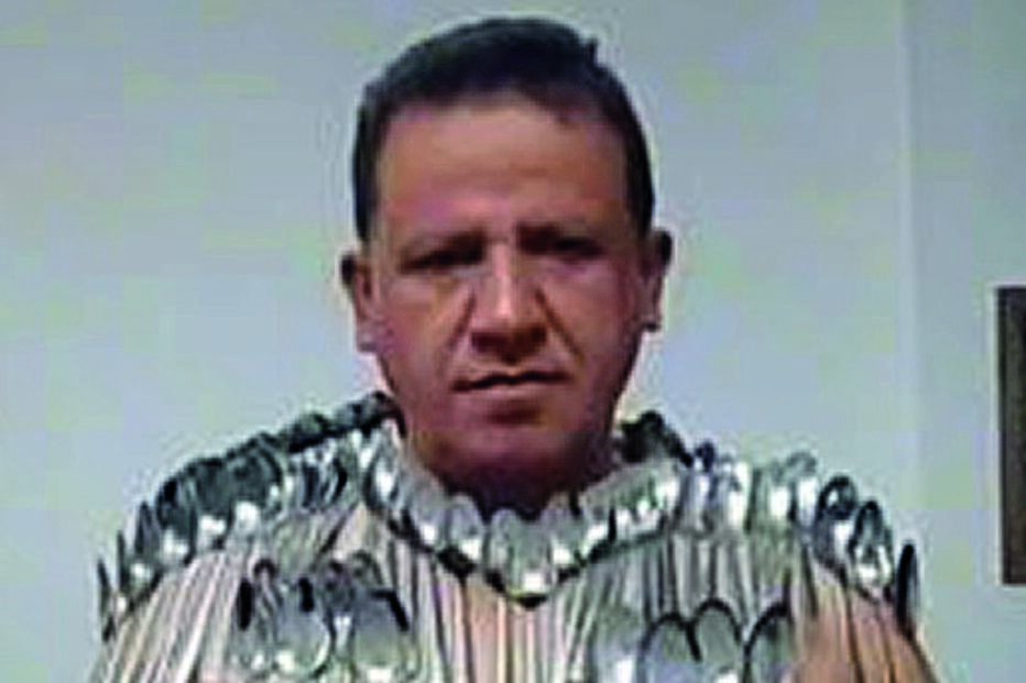 Homem 'magnético' com 85 colheres no corpo
