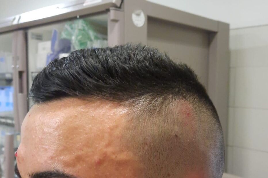 Dois militares da GNR agredidos por quatro homens na vila alentejana de Cuba