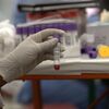 <![CDATA[ Instituto alerta para baixa das reservas de sangue e apela à dádiva antes ou nas férias ]]>