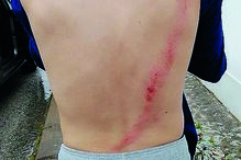 Francisco Laranjeira foi atropelado e o condutor fugiu