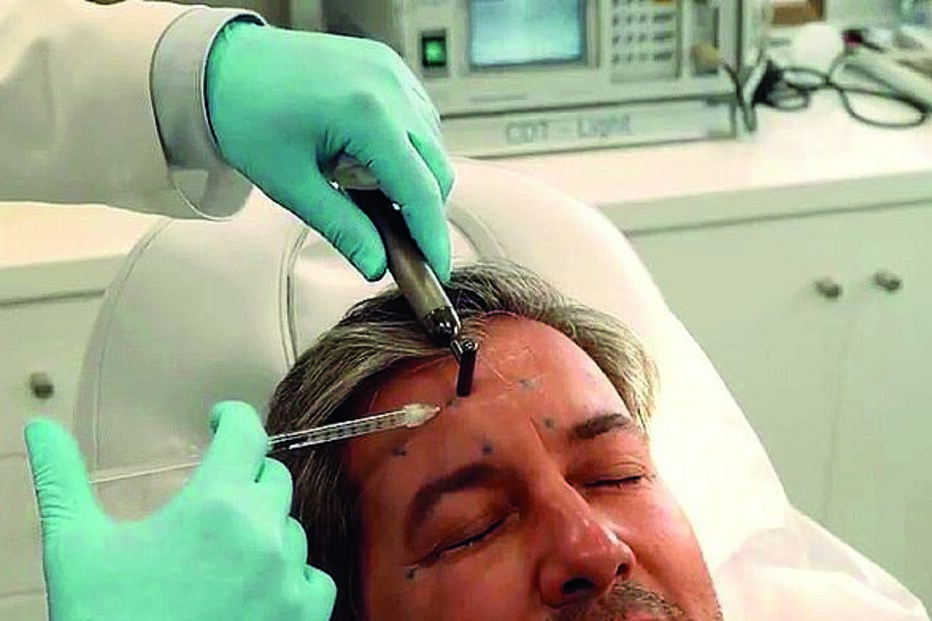 Bruno de Carvalho injeta botox