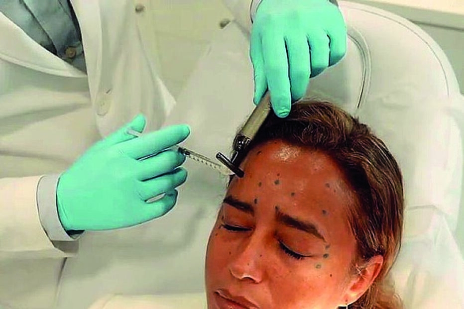 Liliana Almeida durante o procedimento estético