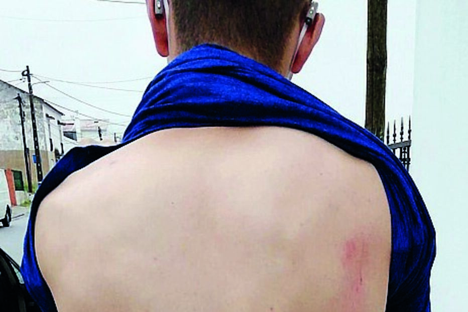 Francisco Laranjeira foi atropelado e o condutor fugiu