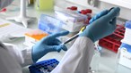 Confirmados 14 casos de surto de varíola dos macacos em Portugal