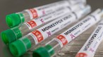 Sobe para 39 o número de casos de varíola dos macacos em Portugal 