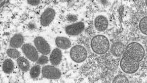 Surto "invulgar" de varíola dos macacos não deve preocupar população, diz OMS
