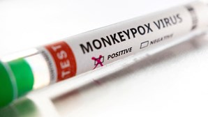 Mais 13 casos confirmados de varíola dos macacos em Portugal