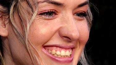 Marta, a menina-milagre que vive há dez anos com duas balas na cabeça, cumpre desejo de ir à Disney 