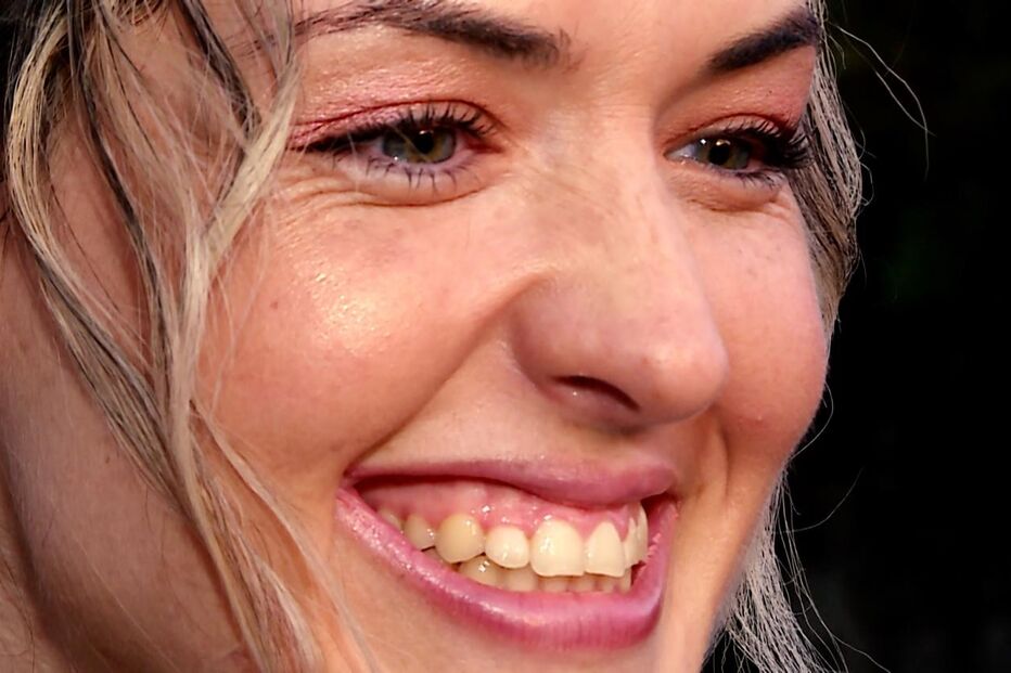 Marta, a menina-milagre que vive há dez anos com duas balas na cabeça, cumpre desejo de ir à Disney 