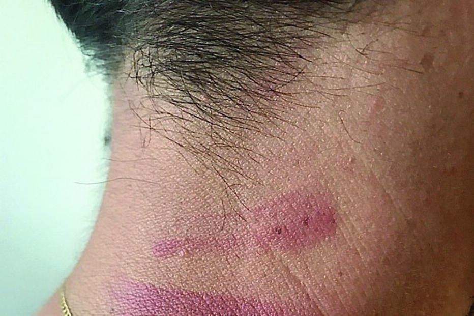 ferimentos, agressões, trabalhador