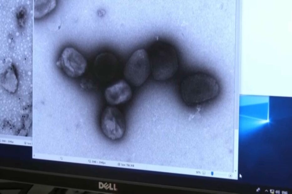 varíola dos macacos, portugal