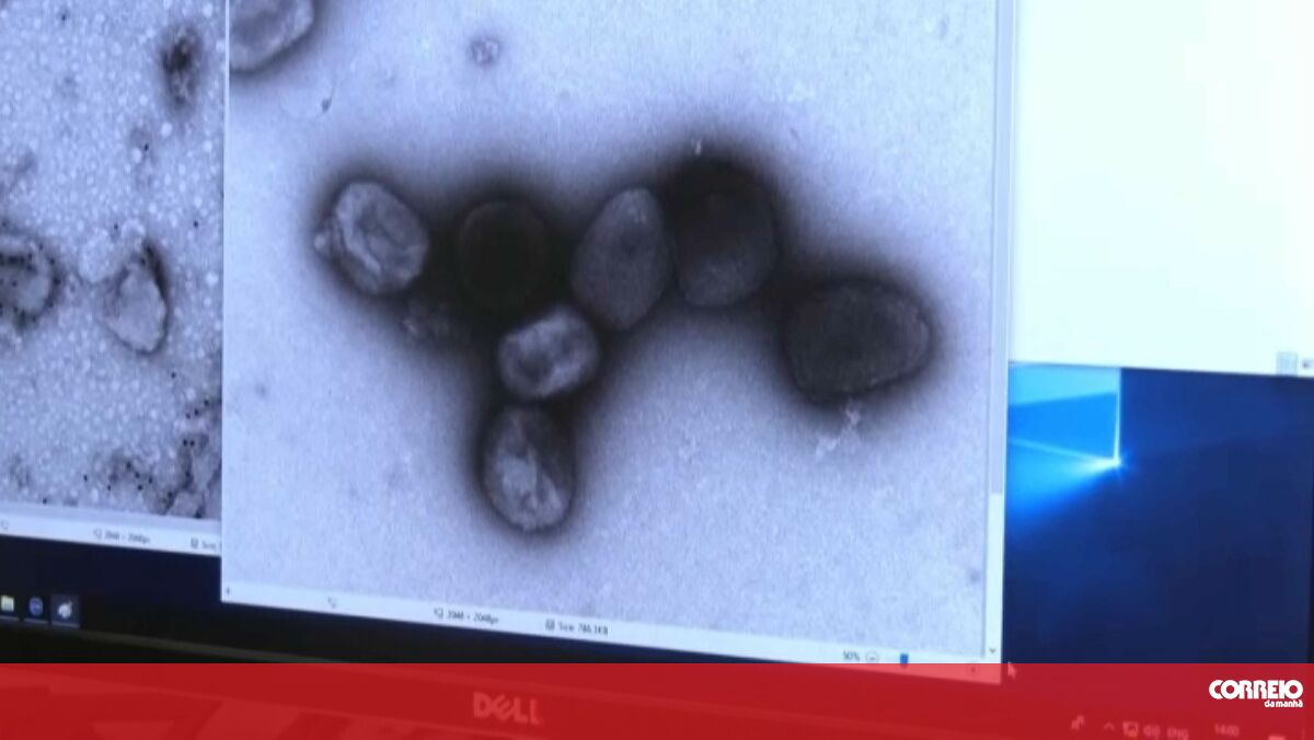 Brazil confirms country’s first death from monkeypox