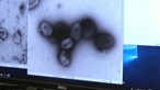 Sobe para 153 o número de casos de varíola dos macacos em Portugal