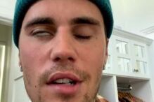 Paralisia de Justin Bieber