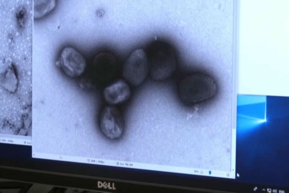 varíola dos macacos, portugal, casos, dgs