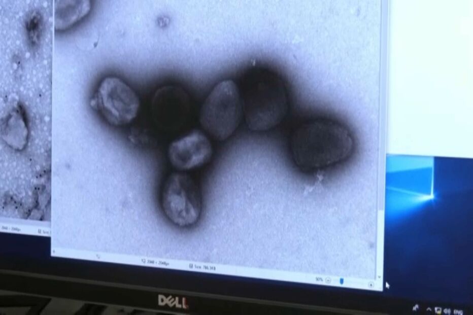 Varíola dos macacos, saúde, infetados, prisão