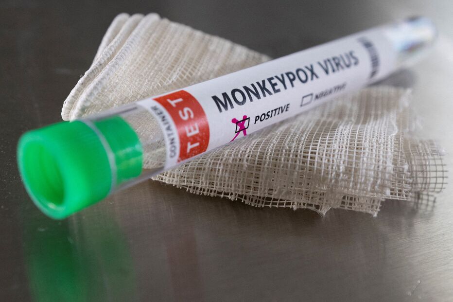 2022-06-18_16_48_37 monkeypox.JPG