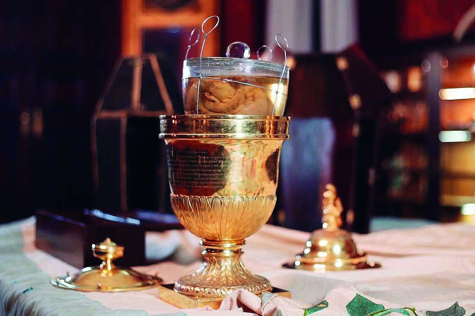 Especialistas recomendam que o coração de D. Pedro IV (D. Pedro I do Brasil) viaje selado e em ambiente pressurizado 