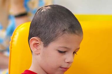 Clínica oferece tratamento capilar a criança de sete anos vítima de bullying