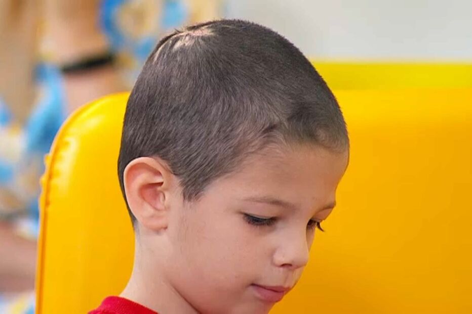 Clínica oferece tratamento capilar a criança de sete anos vítima de bullying