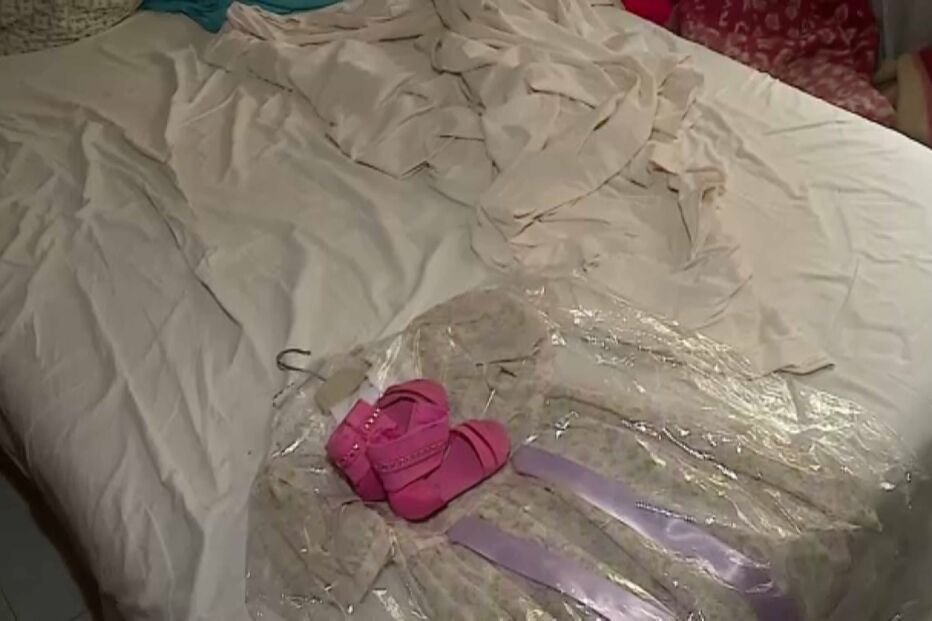 Usam óculos escuros para esconder lesões de Jéssica