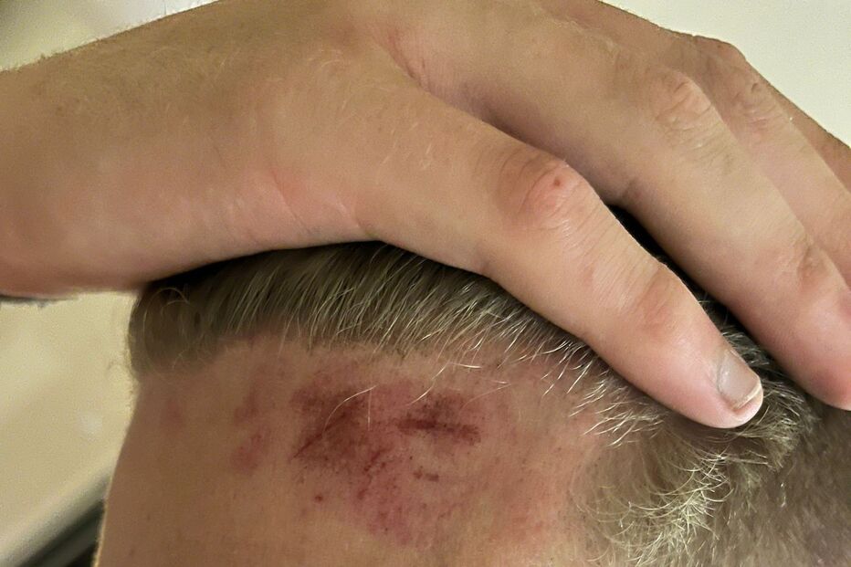 Jovens tiraram fotos das agressões