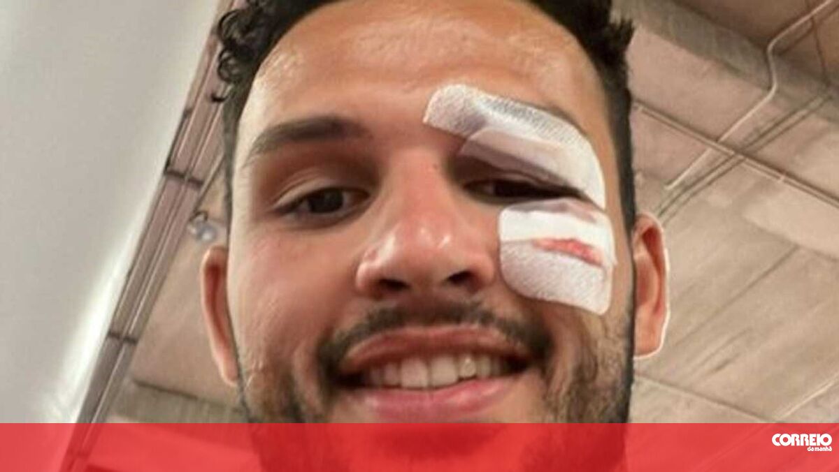 ‘It’s OK’: Gonzalo Ramos shows how he was after 15 stitches to his face