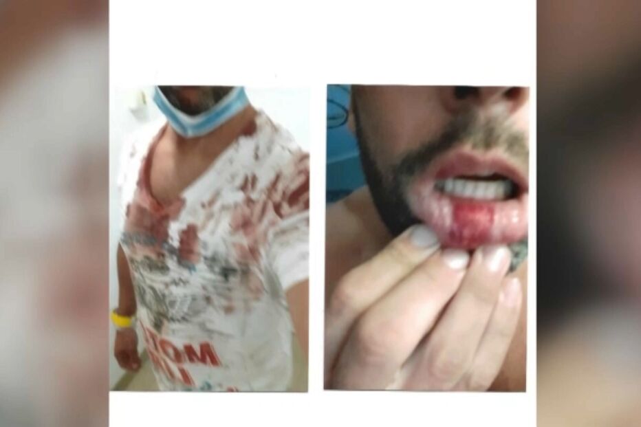 Militar da GNR agredido por intervir em rixa em dia de folga