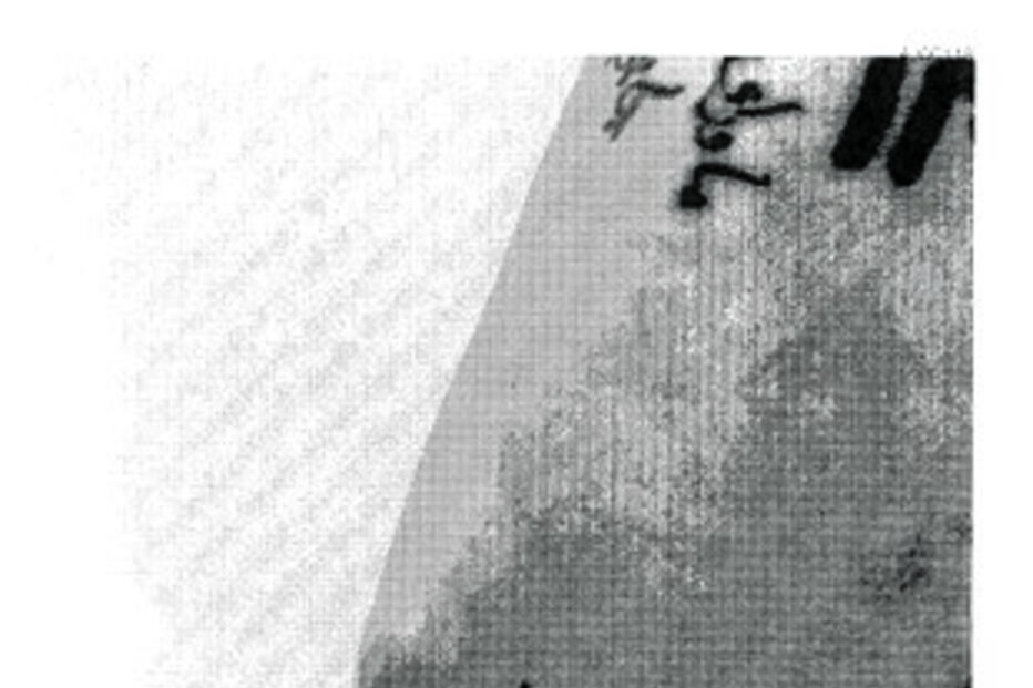 Fotos dos ferimentos no cotovelo e mão da atriz entregues ao FBI 