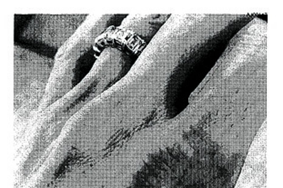 Fotos dos ferimentos no cotovelo e mão da atriz entregues ao FBI 