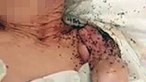 'Tinha formigas no ouvido e estava toda mordida': Filho de idosa acusa lar de Boliqueime de maus-tratos