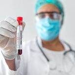 Alerta foi dado pelo Grupo de Ativistas em Tratamentos 