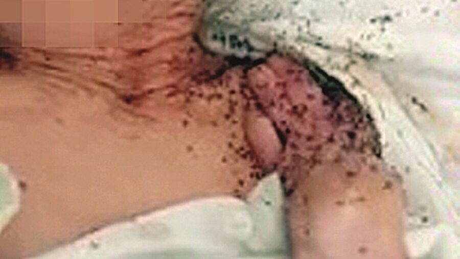 "Vi agressões e comida estragada": Funcionário de lar em Boliqueime descreve cenário de horror