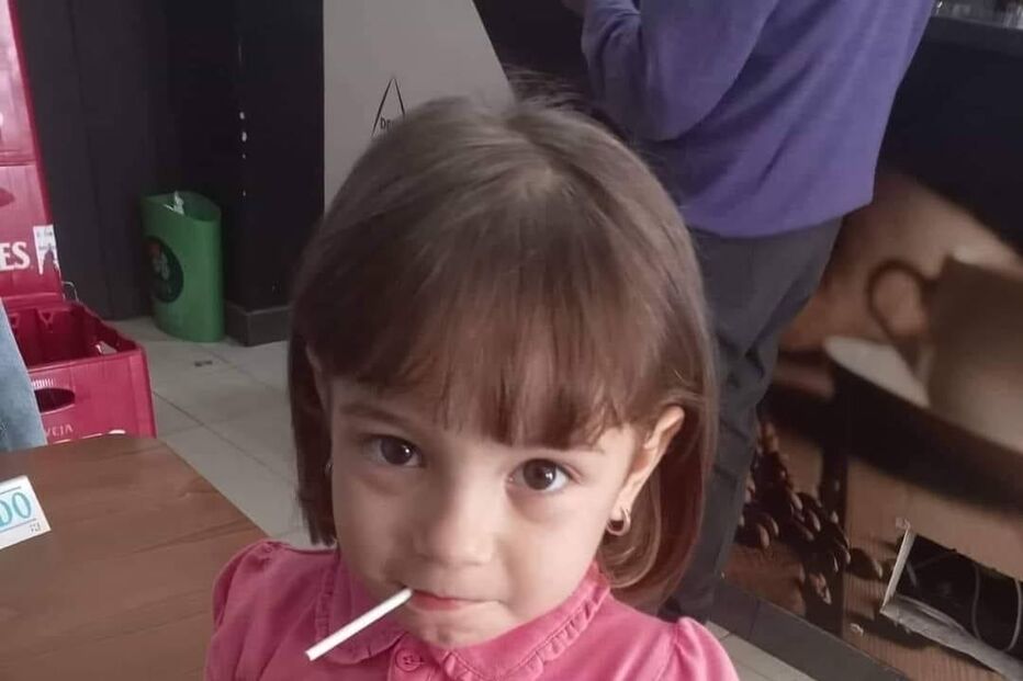 Jéssica ficou com cara desfigurada após ataque com água a ferver