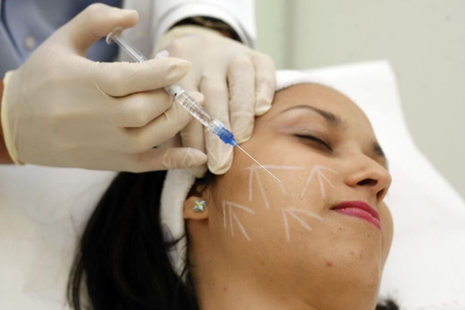 Injeção de botox