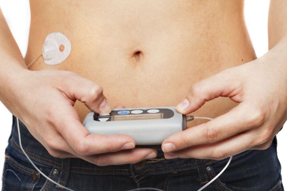 bombas de insulina híbridas